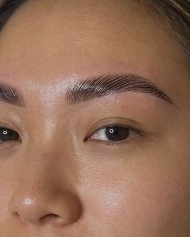 Gelifte en gevormde wenkbrauw na een brow lift